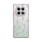 Maska Torbica Silikonska Print Skin za Xiaomi Redmi Note 15 4G/5G Cute Bow cena 2500 din slika
